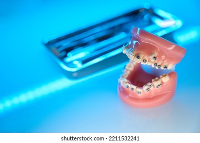 Orthodontic Tools For Teeth Alignment. Jaw With Braces