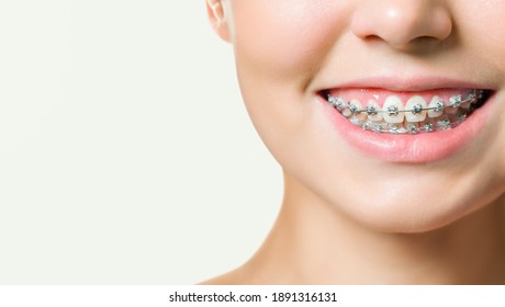 Orthodontic Treatment. Dental Care Concept. Beautiful Woman Healthy Smile close up. Closeup Ceramic and Metal Brackets on Teeth. Beautiful Female Smile with Braces - Shutterstock ID 1891316131