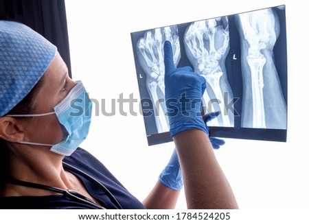 Orthopaedic surgeon studying a x-ray of a broken radius bone in theatre after correctional surgery.