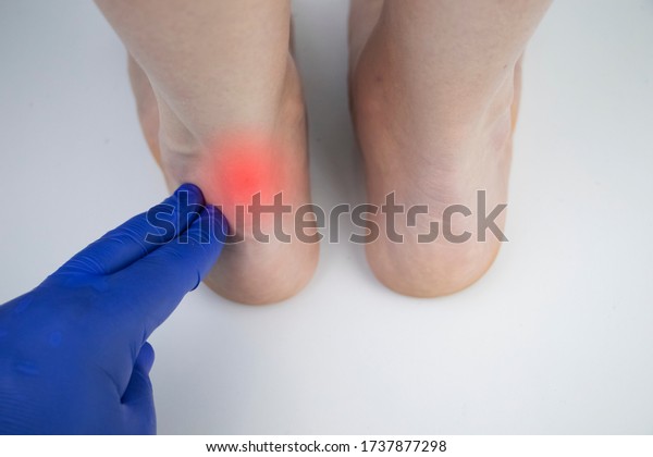 An orthopedic\
doctor examines a woman\'s leg. Achilles tendon and ankle diseases.\
Inflammation of the heel and foot, achillobursitis and achillotomy,\
rheumatism, tendon rupture