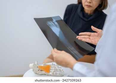 An orthopedic doctor holding an x-ray sheet of ankle and foot bones is explaining to a patient about foot bone problems. Concept of health care for feet and foot bones - Powered by Shutterstock