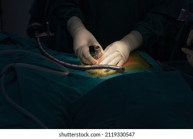 Orthopedic Surgeons Hands In Sterile Gloves With Specific Instruments And A Suction Tube Operating The Human Spine For Minimal Invasive Spinal Surgery