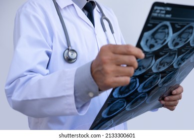 Orthopedics Surgeon Doctor Examining Patient's Knee Joint X-ray Films, MRI Bone, CT Scan In At Radiology Orthopedic Unit In Hospital. Knee Joint Film X Ray, Close Up