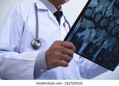 Orthopedics Surgeon Doctor Examining Patient's Knee Joint X-ray Films, MRI Bone, Ct Scan In At Radiology Orthopedic Unit In Hospital. Knee Joint Film X Ray, Close Up