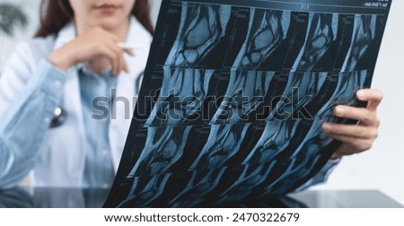 Orthopedics surgeon doctor examining patient's knee joint x-ray films, MRI bone, ct scan in at radiology orthopedic unit in hospital. knee joint film x ray, close up