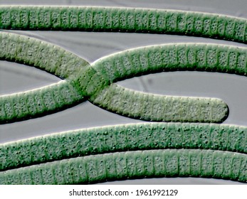 Oscillatoria, Filaments Of Cyanobacteria (Blue Green Algae), Light Microscope Image Of  Living Cells