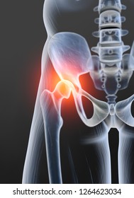 Osteoarthritis Painful Hip Joint 3d Illustration Stock Photo 1264623034 ...