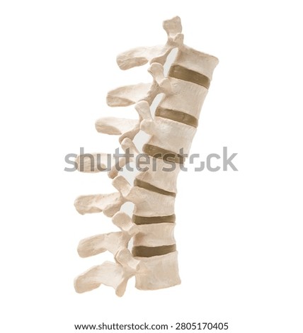 osteoporosis in back bone model isolated on white background with clipping path.