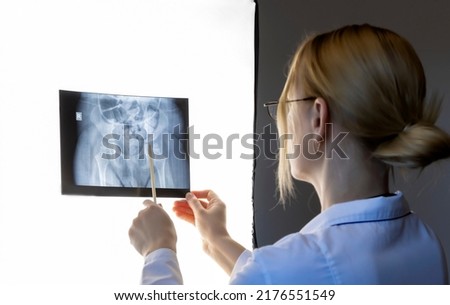 Osteotomy of the femur. The doctor examines the X-ray picture before the operation. Focus on X-ray.