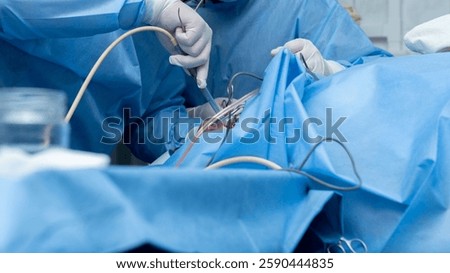 Otolaryngologist performs tonsillectomy, removal of tonsils, ENT. septoplasty, maxillofacial surgery.An array of medical instruments and hoses is visible, indicating a sterile surgical environment. 