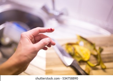 Ouch! Woman Cut Her Finger While Cooking A Dinner In Her Kitchen.