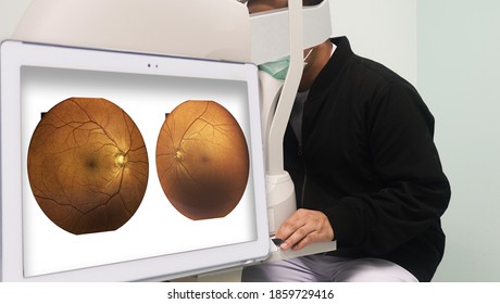 Out of focus patients are examining their eyesight with a Optical Coherence Tomography in a screening room for patients at risk of diabetes.Medical healthcare concept.