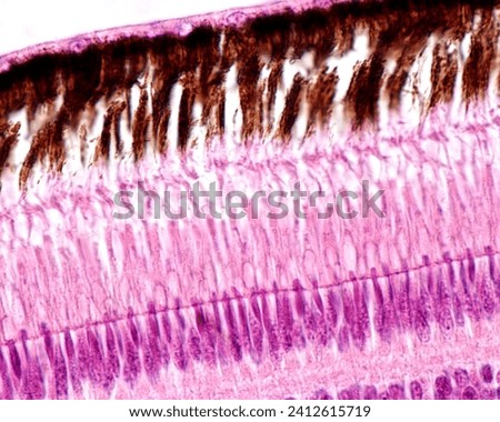 Outer layers of the retina of a bird. From top to bottom: pigment epithelium layer with processes full of melanin granules, rod and cones layer, external limiting membrane, outer nuclear layer