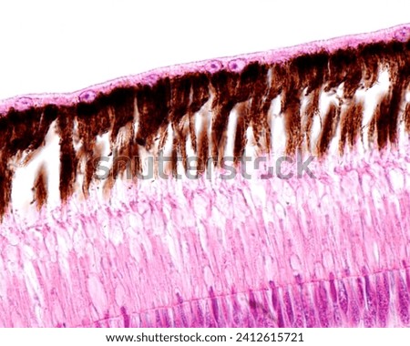 Outer layers of the retina of a bird. From top to bottom: pigment epithelium layer with processes full of melanin granules, rod and cones layer, external limiting membrane, outer nuclear layer
