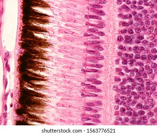 Outer layers of retina. From top to bottom: pigment epithelium, rod and cones, external limiting membrane, outer nuclear, outer plexiform and inner nuclear layers. (Bird retina)
