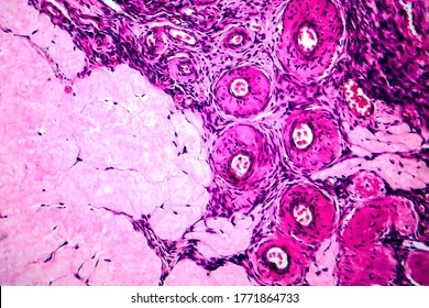 Ovarian follicular cyst, light micrograph, photo under microscope