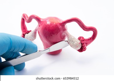 Ovarian gynecologic surgery concept. Hand of surgeon with scalpel near female genitals symbolizes surgical intervention such as cancer, removing ovaries and tubes, cysts and cystectomy as treatment - Shutterstock ID 653984512