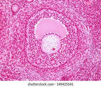 Ovarian Secondary Follicle Showing Oocyte, Antrum Or Follicular Cavity, And The Granulosa And The Theca Layers.