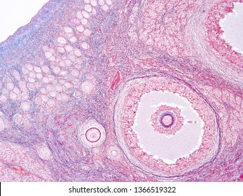 ovary of human tissue
