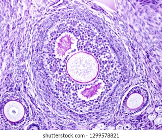 103 Granulosa cell Images, Stock Photos & Vectors | Shutterstock