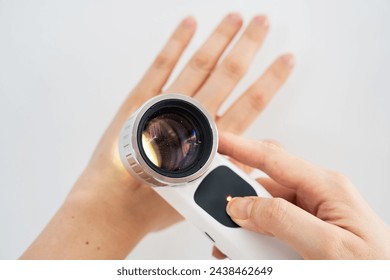 Overhead image of hands are using a dermatoscope to examine nevi (moles) on the surface of a hand against a white background showing the importance of skin examinations for early detection of melanoma - Powered by Shutterstock