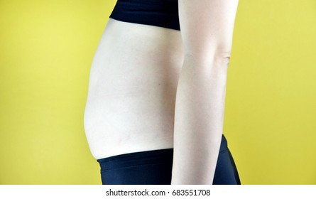 Overweight Fat Woman, Middle-aged Woman With Excessive Belly Fat, Side View Of Woman Muffin Top Waistline.