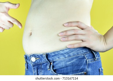 Overweight Fat Woman, Middle-aged Woman With Excessive Belly Fat, Side View Of Woman Muffin Top Waistline.