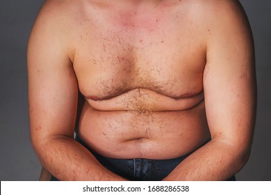 Fat Husband Naked - Naked Fat Males Pecs Nipples | Gay Fetish XXX