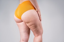 Overweight Woman Fat Image & Photo (Free Trial)