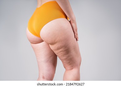Overweight thigh, woman with fat hips and buttocks, obesity female body with cellulite on gray background, studio shot - Shutterstock ID 2184792627