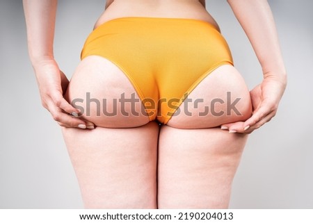 Overweight thigh, woman with fat hips and buttocks, obesity female body with cellulite on gray background, studio shot