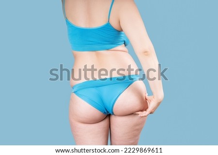 Overweight thigh, woman with fat hips and buttocks, obesity female body with cellulite on blue background, studio shot