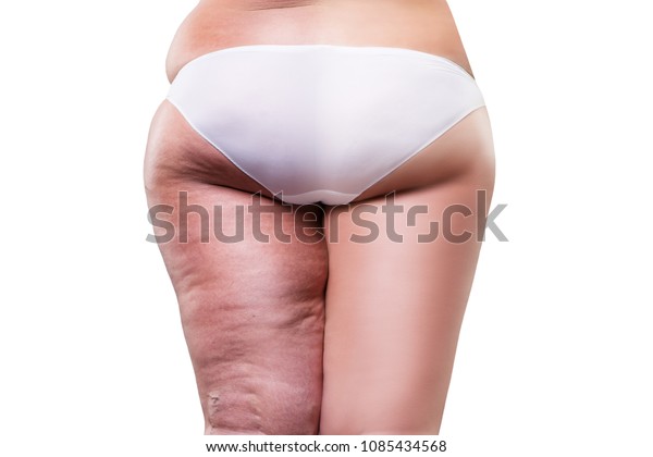 Overweight Woman Fat Cellulite Legs Buttocks Stock Photo Edit Now