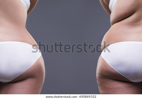 太い脚と臀部を持つ太った女性 コンセプトの前に グレイの背景に肥満女性の体 背面 の写真素材 今すぐ編集