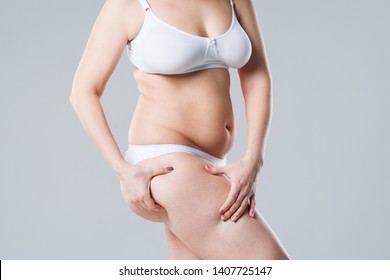 Overweight Woman Fat Legs Obesity Female Stock Photo (Edit Now) 1407725147