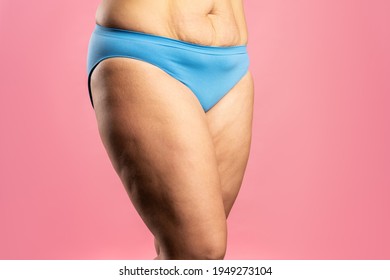 Overweight woman with fat thighs and cellulite, obesity female legs on pink background