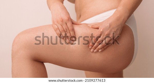 Overweight woman with fat thighs. Hand of fat woman\
holding excessive\
thigh