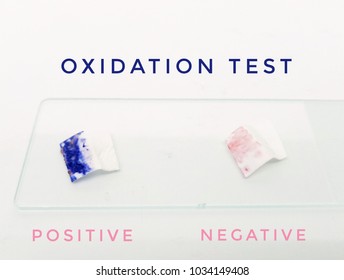 Oxidation test of gram negative bacteria.