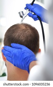 Oxygen Therapy Of The Scalp. The Head Of A Man With Thinning Hair During A Care Treatment