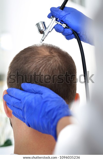 Oxygen Therapy Scalp Head Man Thinning Stock Photo Edit Now