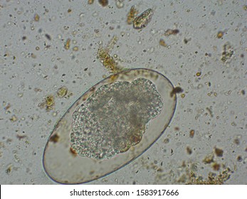 Oxyurid Egg From The Feces Of A Bird Prey With His Larvae Growing Into Int, View Under Microscope At 40x, In A Veterinary Clinic Of Exotic Pet Medicine. 