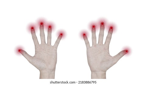 Pain, Tingling And Numbness In Fingertips Of Asian Young Man With Diabetes. Finger Sensation, Hand And Nerves Problems. Fine Touch