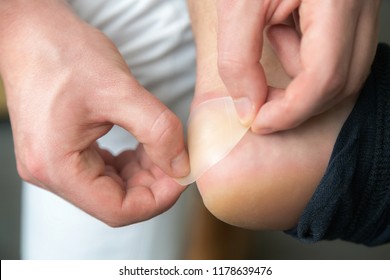 Painful Heel Wound On Mans Feet Caused By New Shoes. Mans Hands Applying Plaster On Terrible Blister On Human Heel. Wet Bloody Painful Skin On Man Foot With Medical Plaster