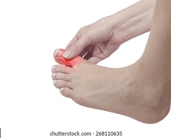 Painful And Inflamed Gout On His Foot Around The Big Toe Area.