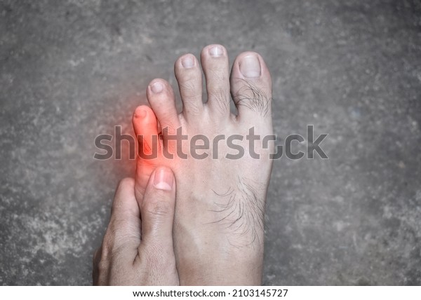 Painful little toe of Asian young man. Caused by\
stubbed toe, broken toe, ingrown toenail, bunions, corns or ill\
fitting shoes.