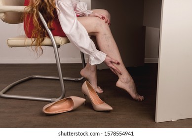 Painful varicose and spider veins on female legs. Woman massaging tired leg in office