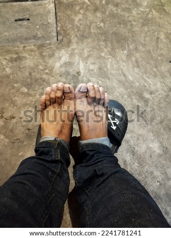 Pale Asian man's feet when they are cold from the rain.