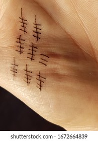 Palm Of The Hand With Signs Of The Passage Of Time Drawn On It. Showing The Concept Of Counting The Days That Pass. Isolated Close-up. They Look Like Scars Of Life. Concept Of Past And Future.