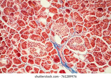 Pancreas With Islet Cells