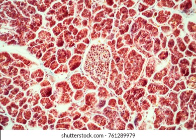 Pancreas With Islet Cells